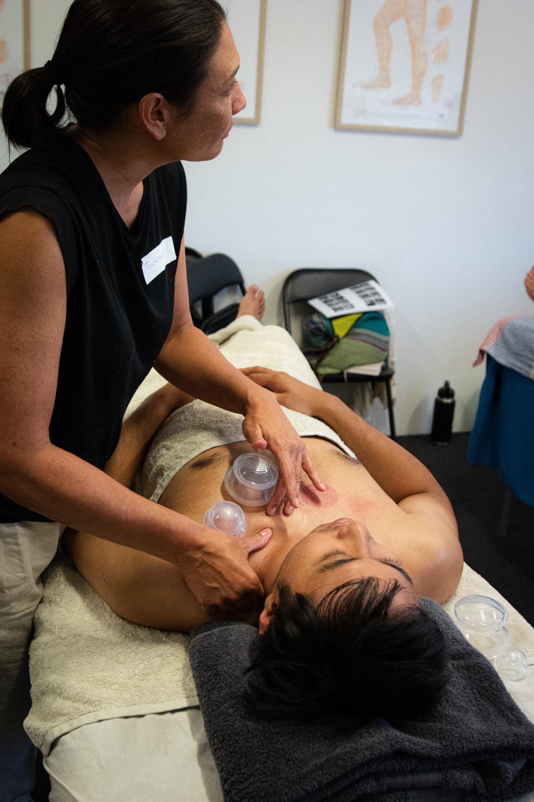 Traditional Chinese Medicine Cupping - Glass Cupping Workshop Student 7