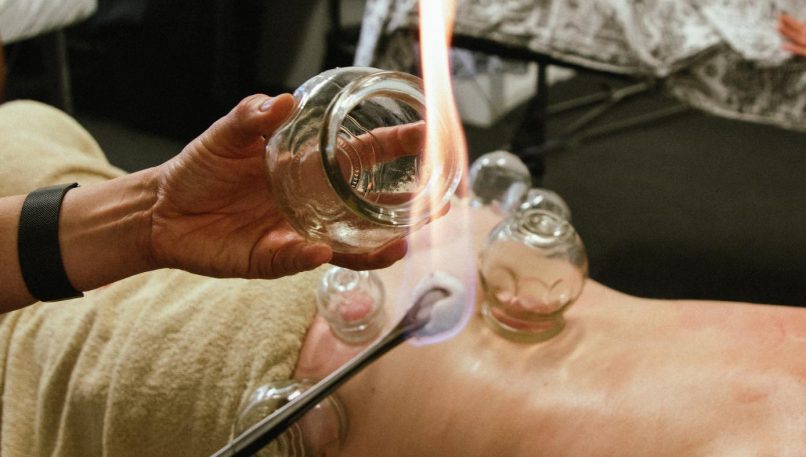 Traditional Chinese Medicine Cupping - Fire Glass Cupping Workshop